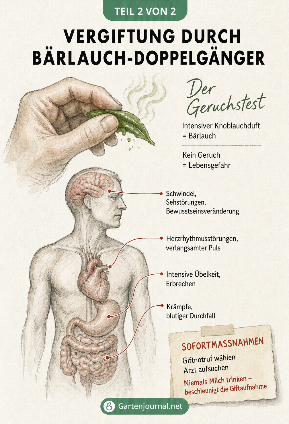 Medizinische Skizze, die den Geruchstest bei Bärlauch zeigt und Vergiftungssymptome durch Doppelgänger an Kopf, Herz, Magen und Darm auflistet.