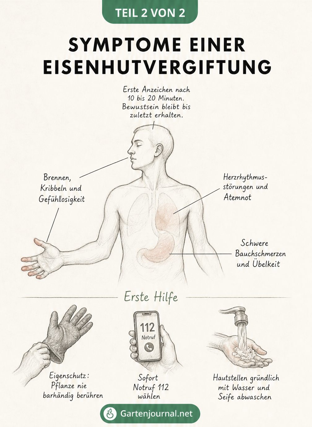 Medizinische Skizze eines menschlichen Oberkörpers zeigt Symptome einer Eisenhutvergiftung wie Kribbeln, Atemnot und Übelkeit sowie Erste-Hilfe-Maßnahmen.