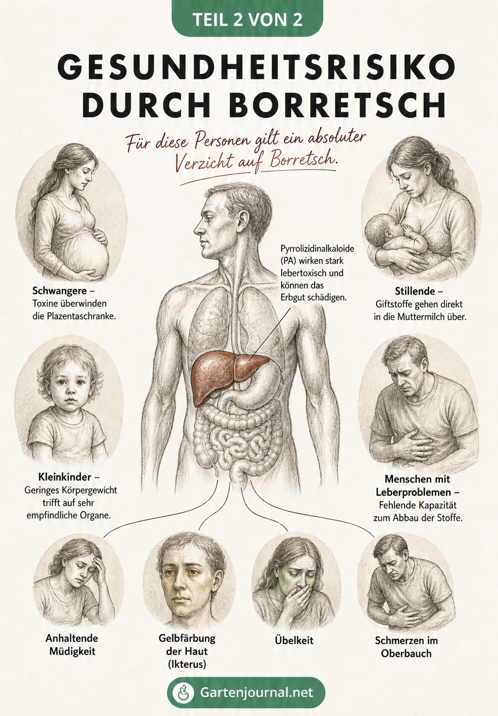 Anatomische Zeichnung eines Torsos mit hervorgehobener Leber und Warnsignalen für Leberbelastung