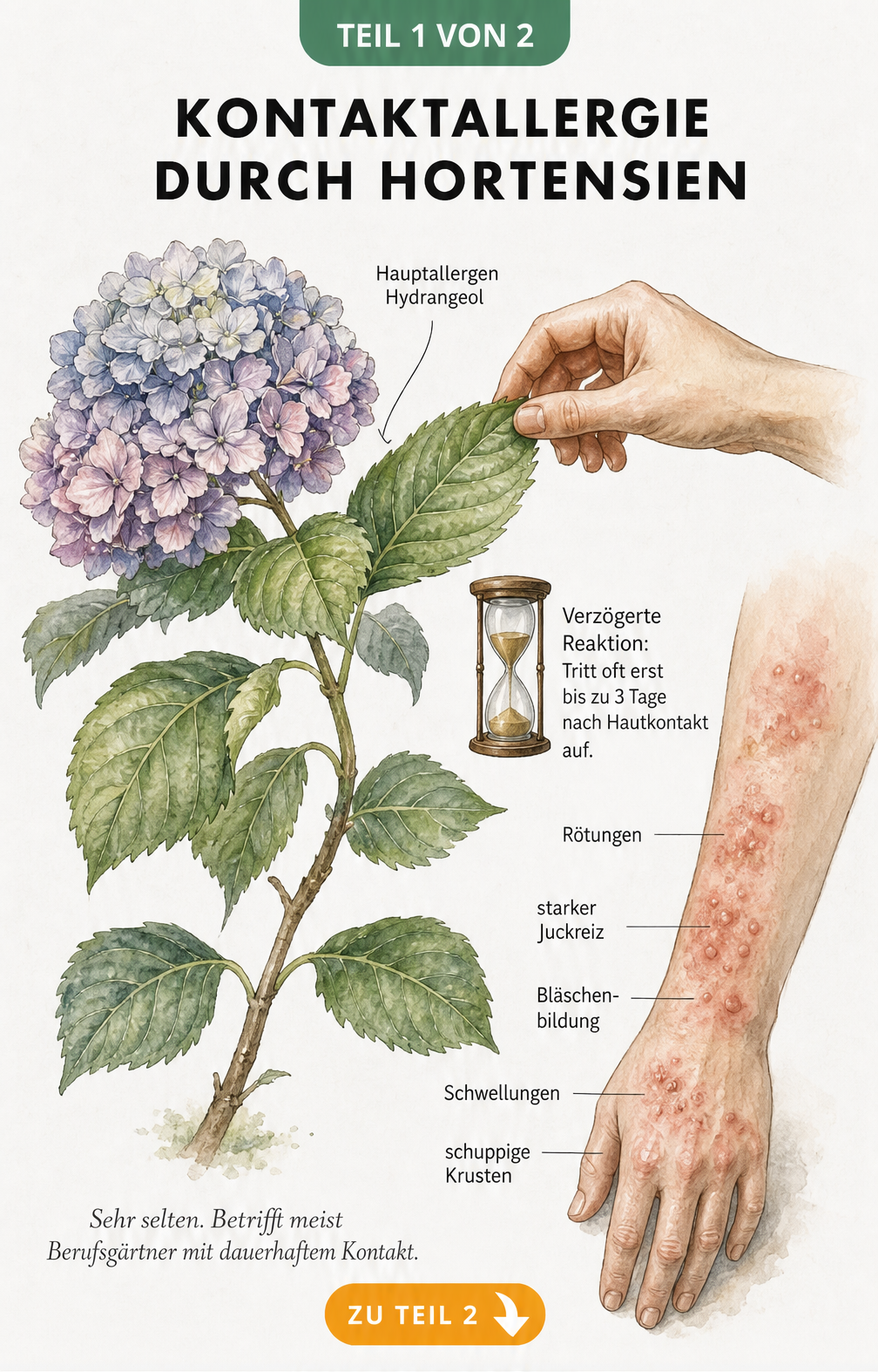 Botanische Illustration eines Hortensienzweigs mit Darstellung der Kontaktallergie durch Hydrangeol und Symptomen auf der Haut