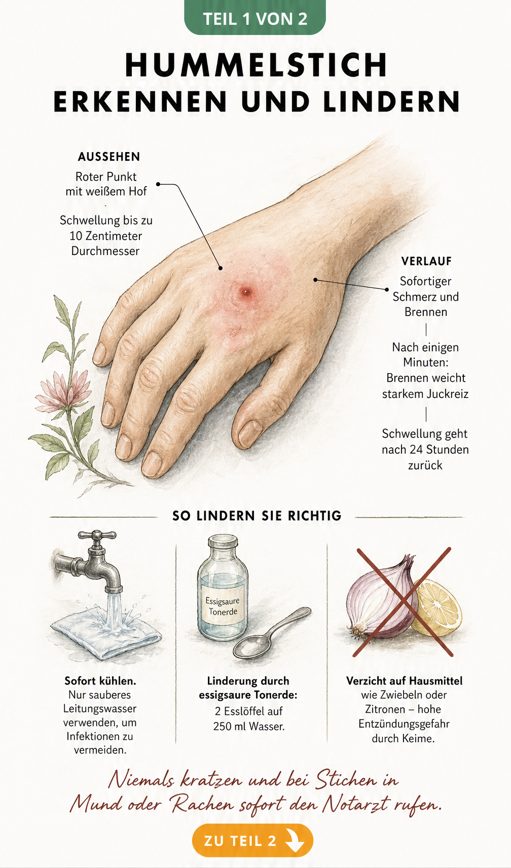 Illustration eines Hummelstichs auf einer Hand mit Erklaerungen zu Symptomen und Erster Hilfe