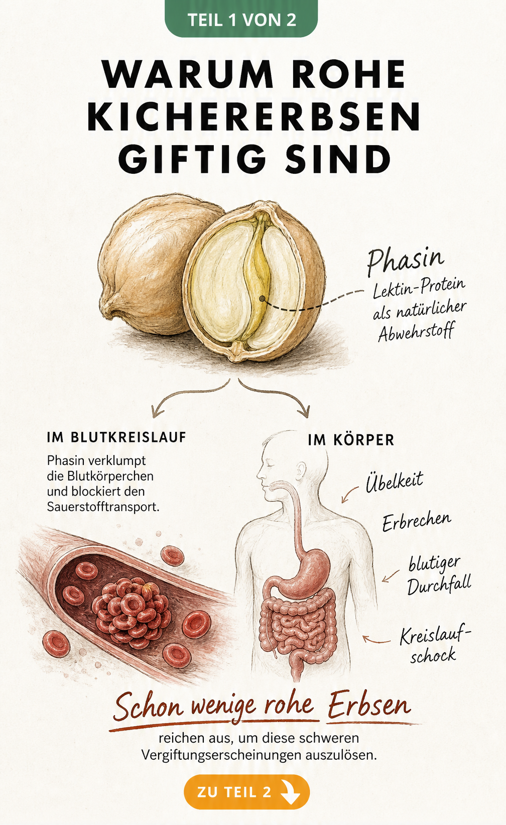 Botanische Illustration einer aufgeschnittenen rohen Kichererbse mit Darstellung der Wirkung von Phasin auf Blutkörperchen und Magen-Darm-Trakt