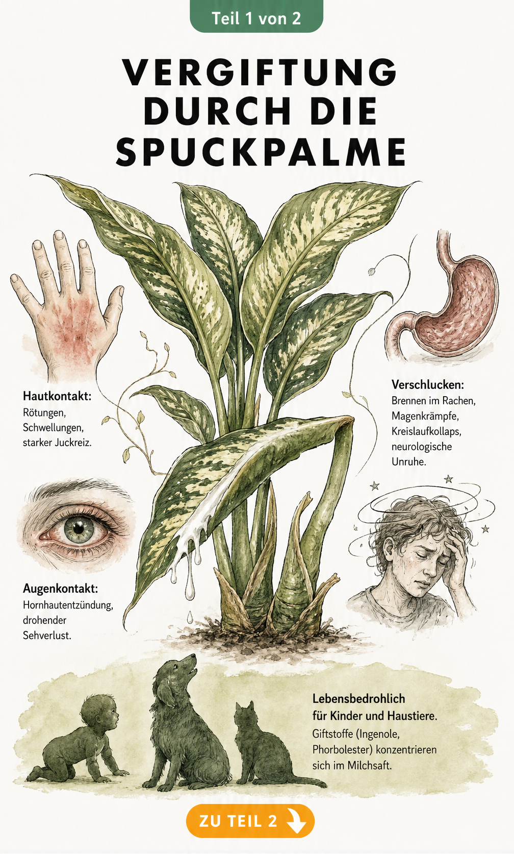Botanische Illustration der Spuckpalme mit austretendem Milchsaft und Darstellung der Vergiftungssymptome bei Hautkontakt und Verschlucken