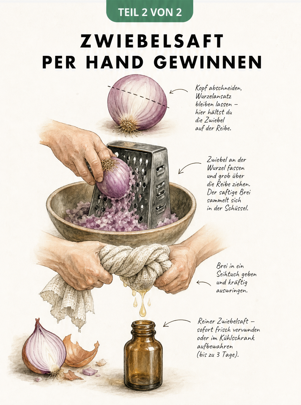 Illustration der manuellen Zwiebelsaftgewinnung: Eine Zwiebel wird an der Wurzel gehalten, über eine Vierkantreibe gerieben und der Brei in einem Seihtuch...